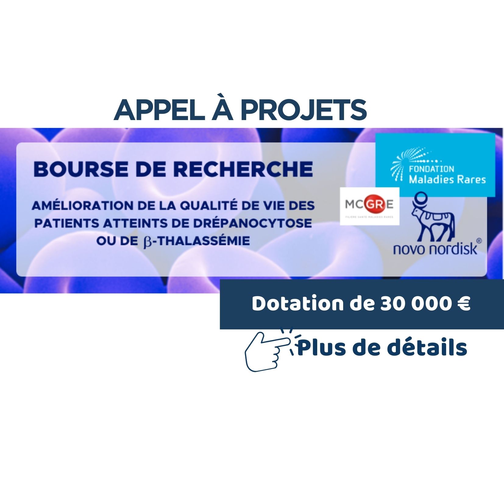 Bourse de 30 000€ !