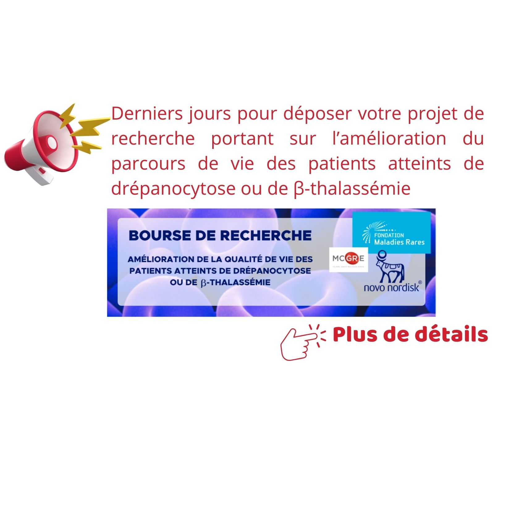 clôture le 12 septembre - 30 000€
